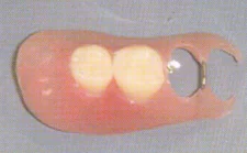 患者さんが喜ぶ第三の義歯